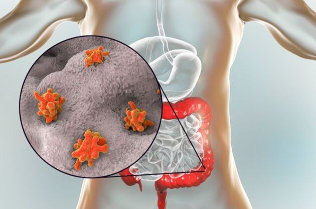 A paraziták típusai az emberi testben