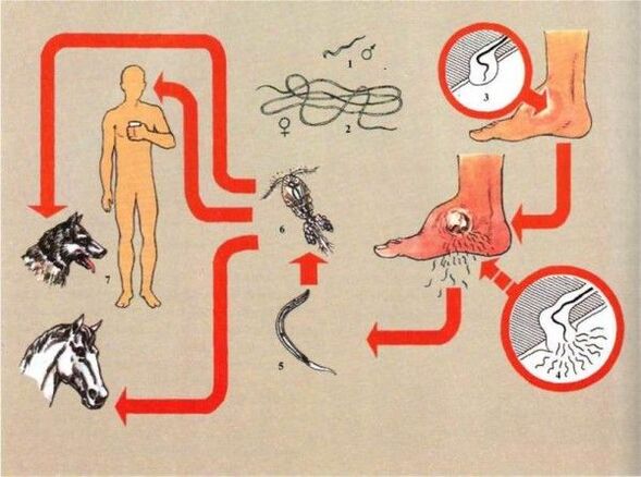 Dracunculiasis kialakulása